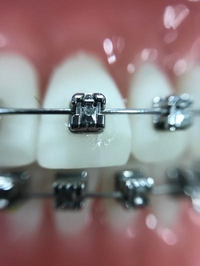 orthodontiste joue les tours